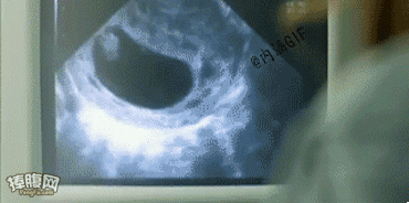 怎么样才能容易怀孕_